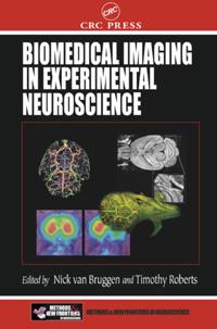 Frontiers in Neuroscience