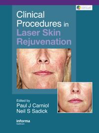 Series in Cosmetic and Laser Therapy