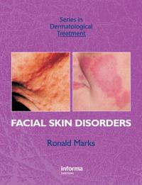 Series in Dermatological Treatment