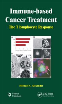 Immune-based Cancer Treatment