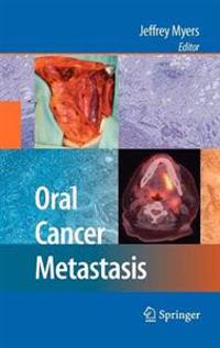 Oral Cancer Metastasis