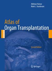 Atlas of Organ Transplantation