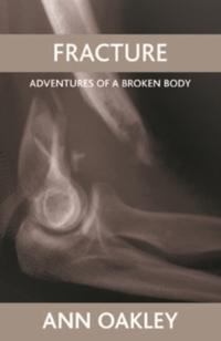 Fracture