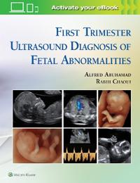 Bokomslag för "First Trimester Ultrasound Diagnosis of Fetal Abnormalities"