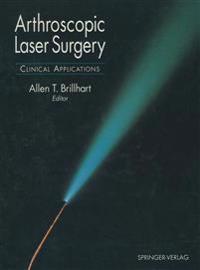 Arthroscopic Laser Surgery