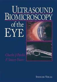 Ultrasound Biomicroscopy of the Eye