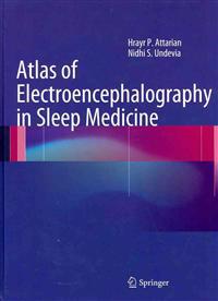 Atlas of Electroencephalography in Sleep Medicine