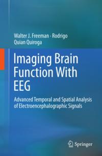 Imaging Brain Function With EEG
