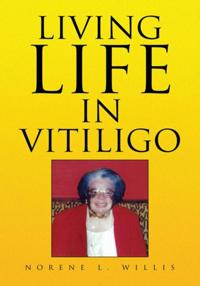 Living Life in Vitiligo