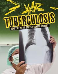 Tuberculosis