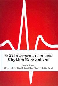 ECG Interpretation and Rhythm Recognition