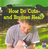 How Do Cuts and Bruises Heal?