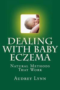 Dealing With Baby Eczema