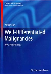 Well-Differentiated Malignancies