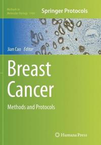 Breast Cancer