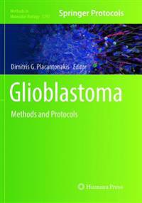 Glioblastoma
