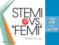 STEMI vs. &quote;FEMI&quote;