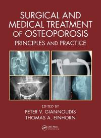 Bokomslag för "Surgical and Medical Treatment of Osteoporosis"