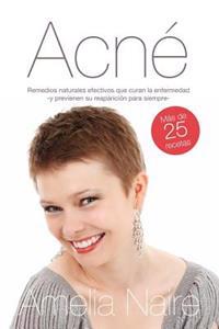 Acné Remedios naturales efectivos que curan y previenen su reaparición: Guía fácil de tratamiento casero del acné