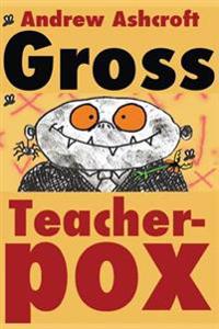 Gross Teacherpox
