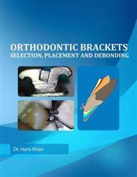 Orthodontic Brackets: Selection, Placement and Debonding