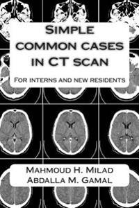 Simple common cases in CT scan: For interns and new residents