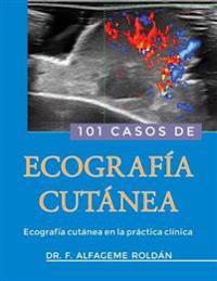 101 Casos de Ecografia Cutanea: Ecografía cutánea en la práctica clínica