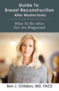 Guide To Breast Reconstruction After Mastectomy: What To Do After You Are Diagnosed