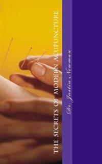 Secrets of Modern Acupuncture: How to Maximize Your Health and Wellbeing