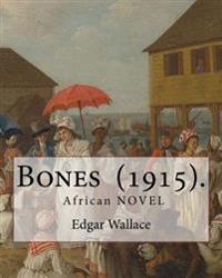Bones