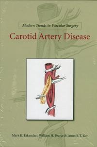 Modern Trends in Vascular Surgery: Carotid Artery Disease
