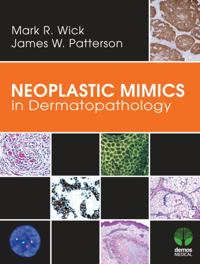 Pathology of Neoplastic Mimics