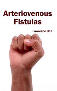 Arteriovenous Fistulas
