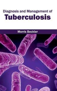 Diagnosis and Management of Tuberculosis