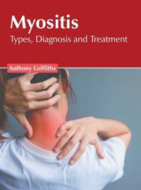 Myositis: Types, Diagnosis and Treatment