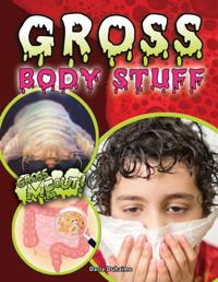 Gross Me Out!