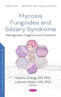 Mycosis Fungoides: Causes, Diagnosis and Treatment
