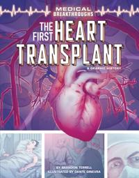 First Heart Transplant