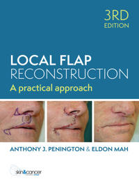 Bokomslag for "Local Flap Reconstruction"