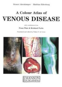 Colour atlas of venous disease