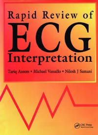Rapid Review of ECG Interpretation