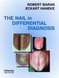 Kirjan kansi "Nail in Differential Diagnosis"