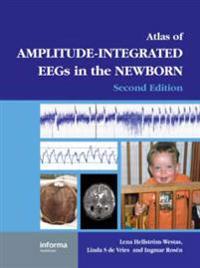Bokomslag för "An Atlas of Amplitude-Integrated EEGs in the Newborn"