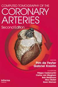Bokomslag for "Computed Tomography of the Coronary Arteries"