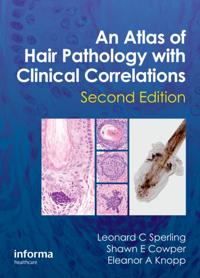Atlas of Hair Pathology with Clinical Correlations