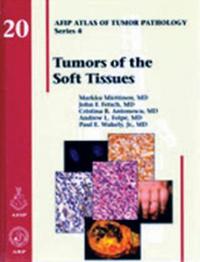 Tumors of the Soft Tissue