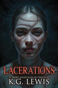 Lacerations