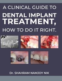 A clinical guide to dental implant treatment, how to do it right.