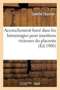 Accouchement Forcé Dans Les Hémorragies Pour Insertions Vicieuses Du Placenta