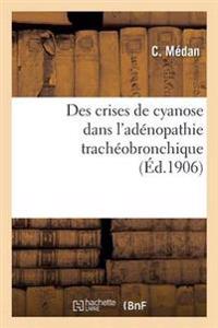 Des Crises de Cyanose Dans l'Adénopathie Trachéobronchique